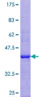 Human ZNF160 Protein (Recombinant GST)