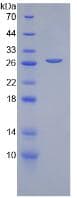 Rat CFD / Factor D / Adipsin Protein (Recombinant His, N-Terminal)