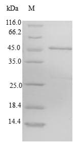 Human CHIC2 Protein (Recombinant GST, N-terminus)