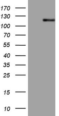 Monoclonal Mouse anti-Human AR / Androgen Receptor Antibody (clone OTI1D3, aa420-659, IHC, WB)