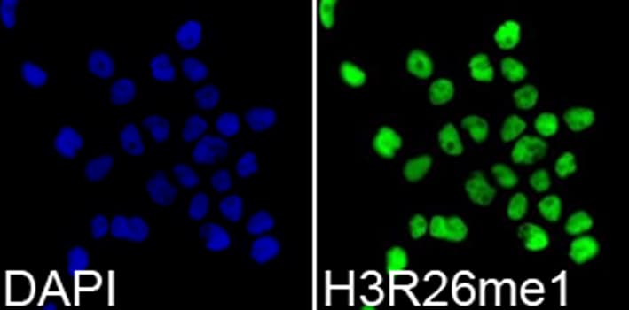 Histone H3 Antibody (Methyl-Arg26)