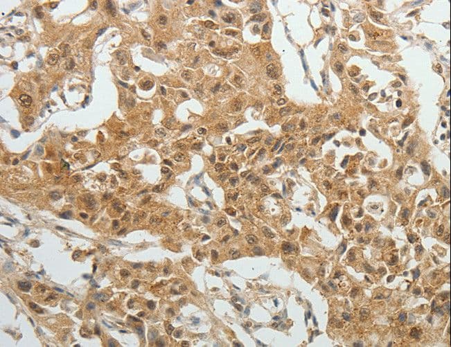 SYT6 / Synaptotagmin 6 Antibody