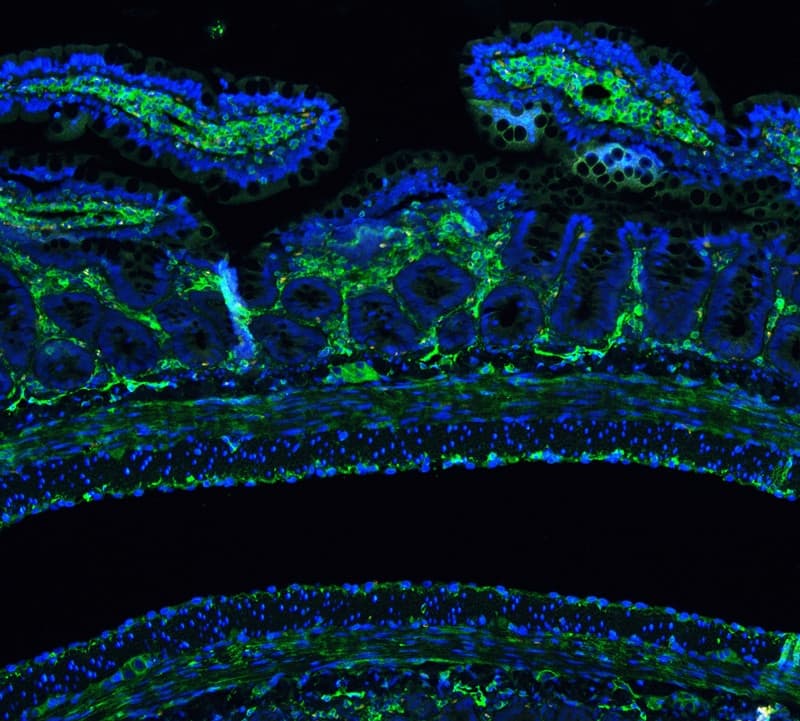 Polyclonal Rabbit anti-Human ANXA6/Annexin A6/Annexin VI Antibody (IHC, WB)
