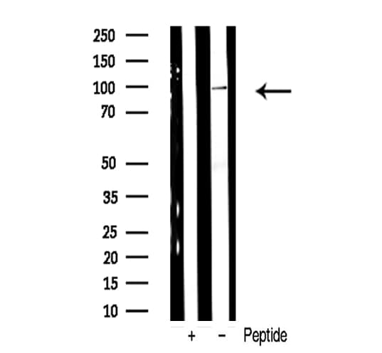 ADAM17 / TACE Antibody