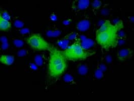 Monoclonal Mouse anti-Human L1CAM Antibody (clone OTI2H5, IHC, IF, WB)