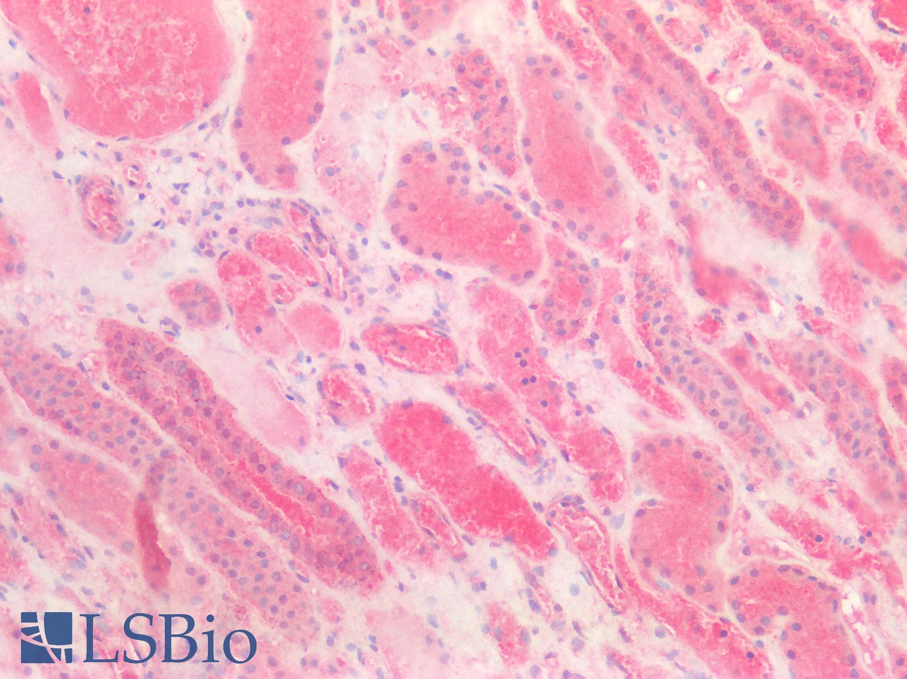 PathPlus™ Polyclonal Rabbit anti-Human CDH1 / E Cadherin Antibody (IHC)