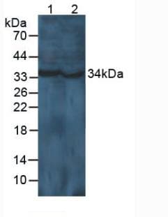 CCND1 / Cyclin D1 Antibody (aa1-295)