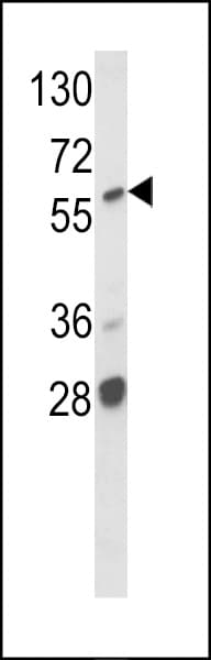 Polyclonal Rabbit anti-Human ARAF / ARAF1 / A-RAF Antibody (aa256-286, IHC, WB)