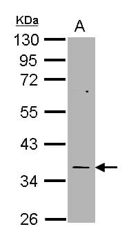 Polyclonal Rabbit anti-Human TS / Thymidylate Synthase Antibody (aa122-313, WB)