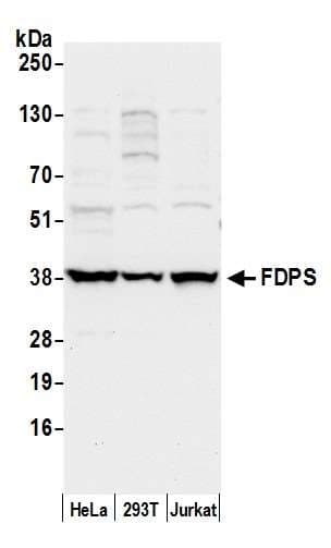 FDPS Antibody (aa50-100)