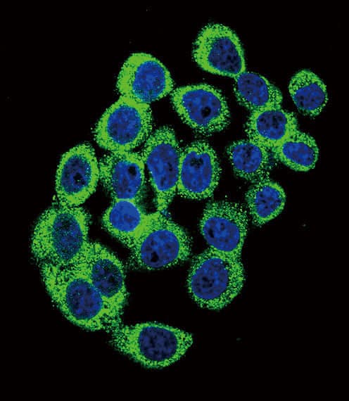 ATXN1 / SCA1 Antibody (Ser776)
