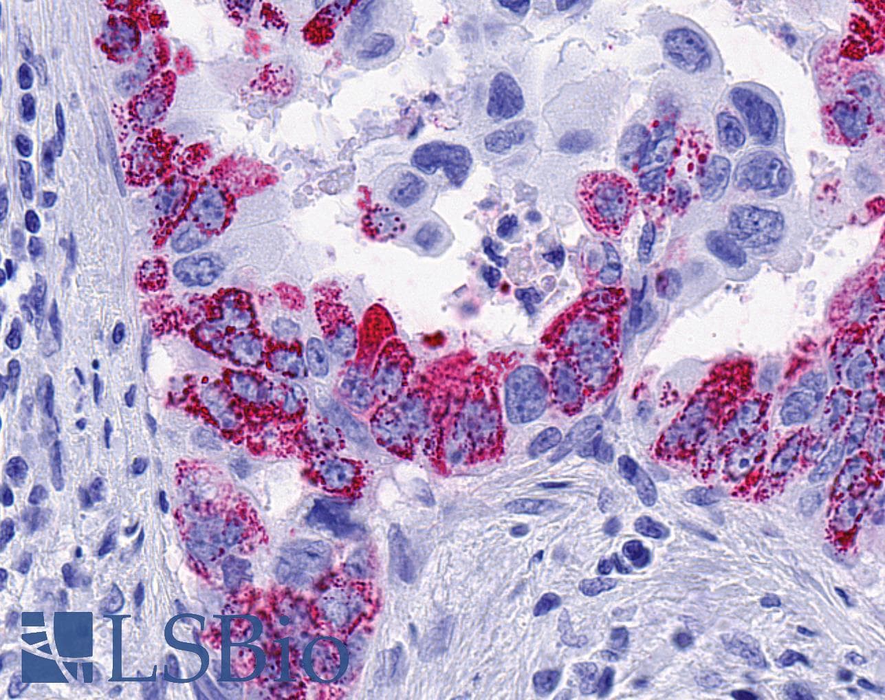 IHC-plus™ Polyclonal Rabbit anti-Human FFAR2 / GPR43 Antibody (Cytoplasmic Domain, IHC)