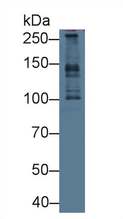 PCM1 Antibody (aa1913-2024)