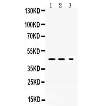 Neuroserpin Antibody (aa272-310)