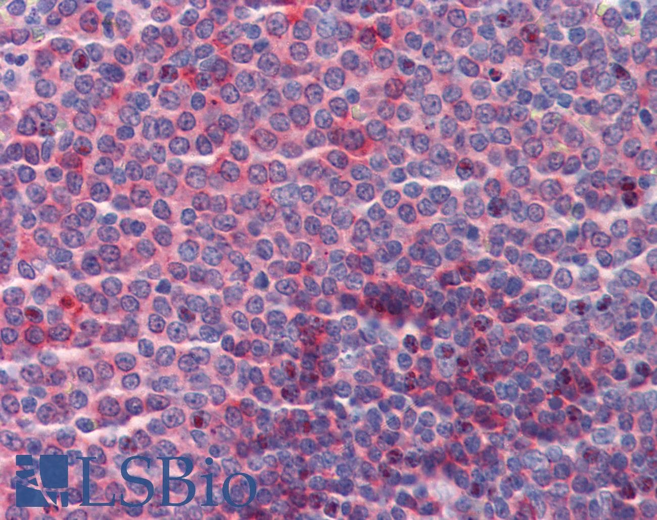 IHC-plus™ CUEDC2 Antibody
