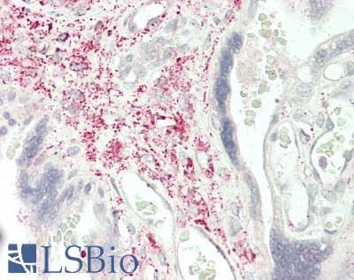 Polyclonal Rabbit anti-Human SLIT2 Antibody (aa1160-1333, IHC, WB)