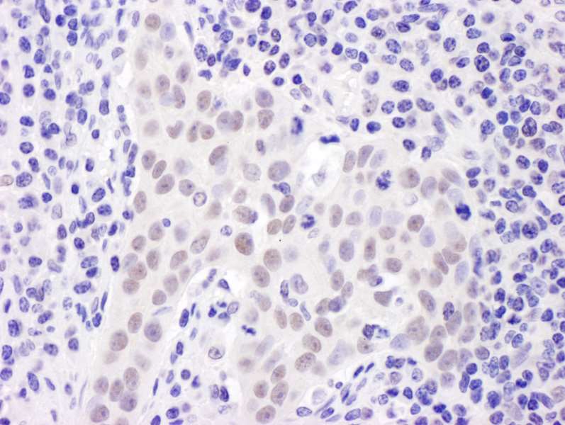 Polyclonal Rabbit anti-Human UBR5 Antibody (aa600-650, IHC, WB)
