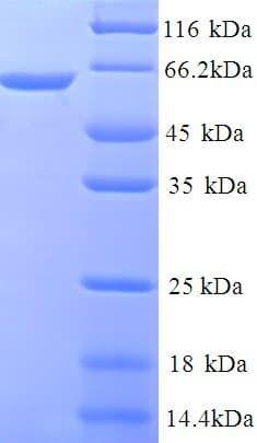 Human C1orf106 Protein (Recombinant His)
