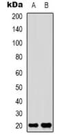 AK6 / Adenylate Kinase 6 Antibody (N-Terminus)
