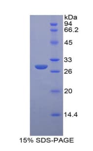 Rat IGF2R / CD222 Protein (Recombinant His, N-Terminal)