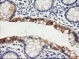 Monoclonal Mouse anti-Human LIPG / Endothelial Lipase Antibody (clone OTI4C10, IHC, WB)