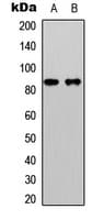CTNNB1 / Beta Catenin Antibody (phospho-Ser33)