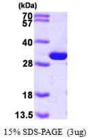 Human PGAM1 Protein (Recombinant His)