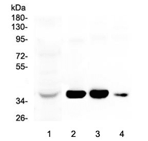 Polyclonal Rabbit anti-Human AKR1D1 Antibody (IHC, WB)