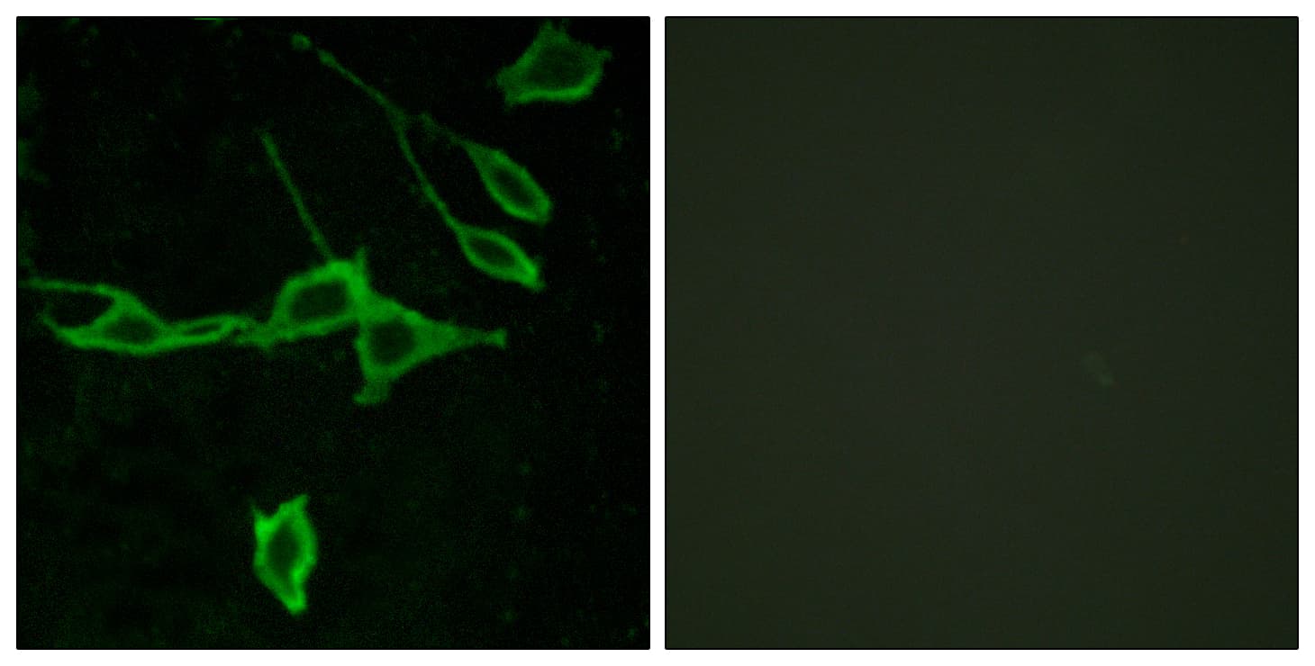 IHC-plus™ HRH1 / Histamine H1 Receptor Antibody (aa141-190)