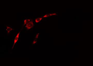 Polyclonal Rabbit anti-Human RAB3GAP2 / p150 Antibody (IHC, IF, WB)