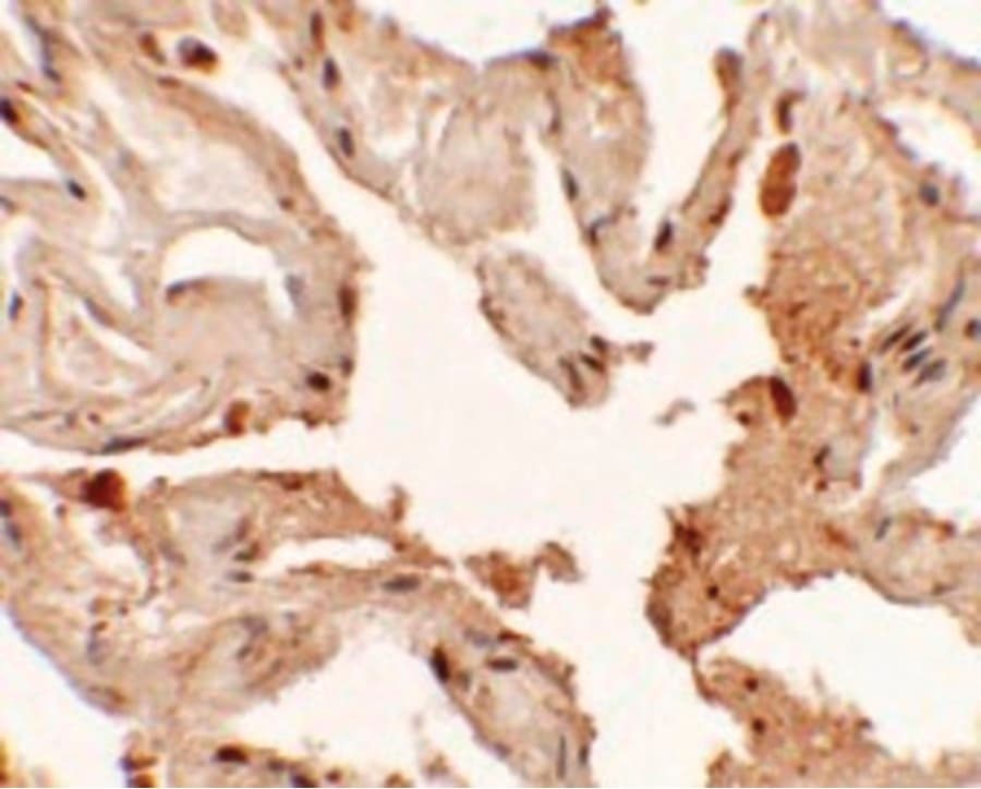Polyclonal Rabbit anti-Human NKX2-1 / Thyroid-Specific TF Antibody (IHC, IF, WB)