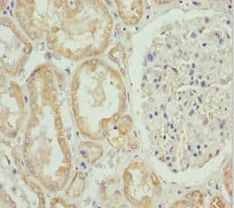 HADH Antibody