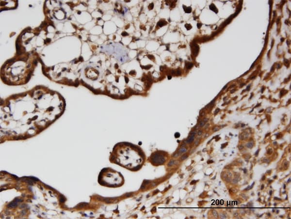 Monoclonal Mouse anti-Human HECTD2 Antibody (clone 3D6, IHC, WB)