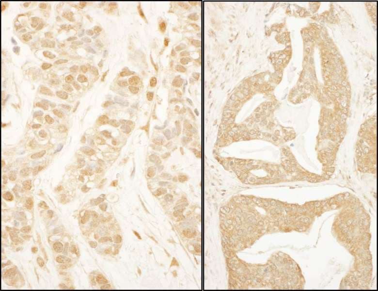 Polyclonal Rabbit anti-Human BTF3 Antibody (aa35-70, IHC)