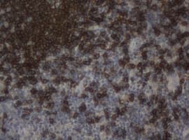 Monoclonal Mouse anti-Human CD20 Antibody (clone OTI2C11, IHC, WB)