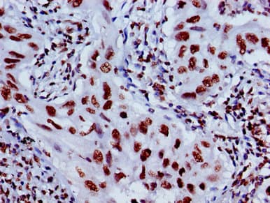 HIST1H4I Antibody