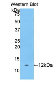 FGA / Fibrinogen Alpha Antibody (aa554-655, PE)