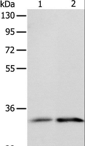 IL1RL1 Antibody