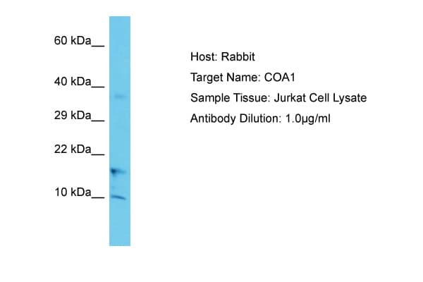 Polyclonal Rabbit anti-Human COA1 Antibody (C-Terminus, WB)