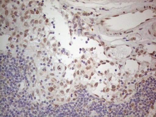 TLK2 Antibody (aa1-296, clone OTI2D10)