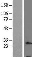 Human C19orf70 / QIL1 Protein (Over-Expression Lysate Myc-DDK (Flag))