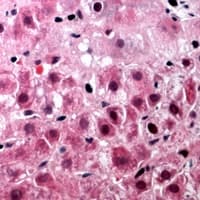 EFTU / TUFM Antibody (Internal)