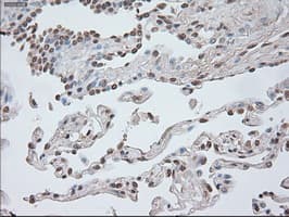 CTNNB1 / Beta Catenin Antibody (clone OTI1F3)