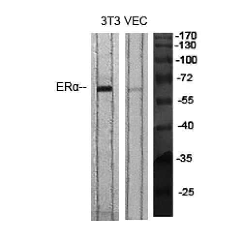 ER Alpha / Estrogen Receptor Antibody (470-550 aa)