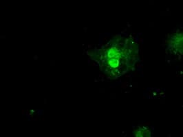 SSX2 Antibody (clone OTI4A11)