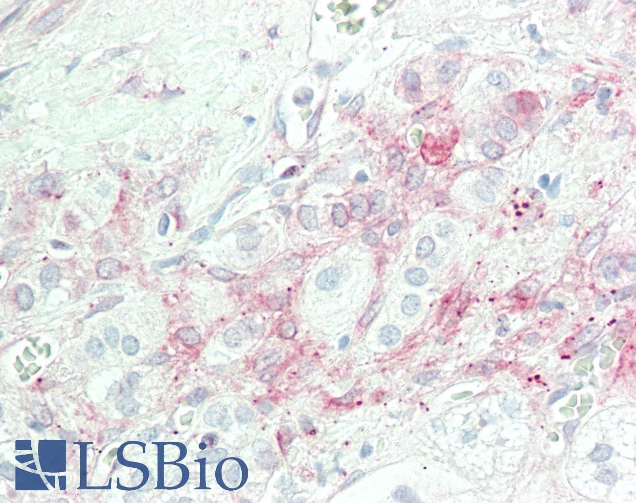 IHC-plus™ PLA2G4A Antibody (aa480-530)