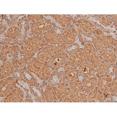 Polyclonal Rabbit anti-Human SP1 Antibody (phospho-Thr739, IHC, IF, WB)