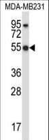 Polyclonal Rabbit anti-Human HCLS1 Antibody (aa362-391, IHC, WB)