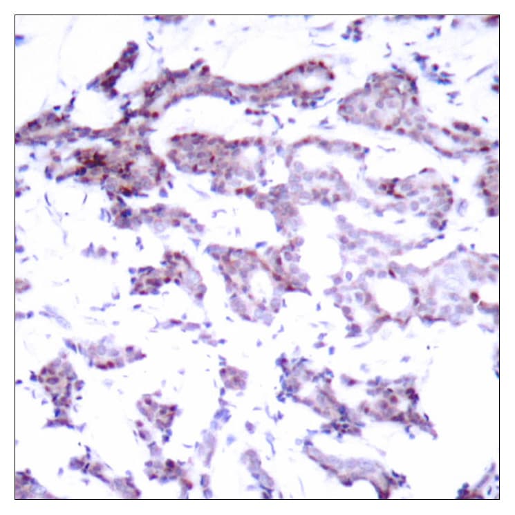 Polyclonal Rabbit anti-Human ELK1 Antibody (aa356-405, IHC, WB)