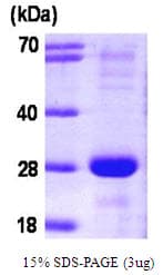 Human SNAP23 / SNAP-23 Protein (Recombinant)